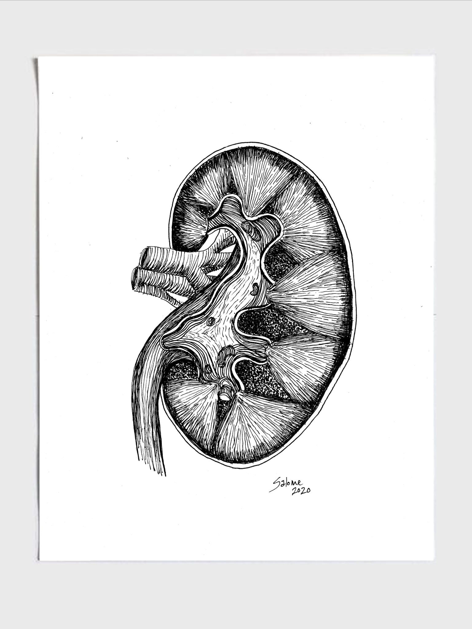 Draw a well labelled diagram of L.S. of the human kidney?
