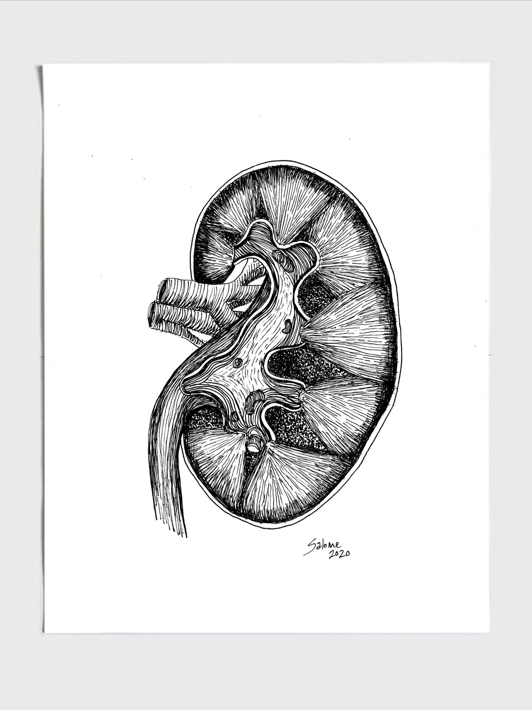 Fig. Human kidney - Biology Tutorial HSC | Facebook